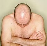Hair Loss in Man